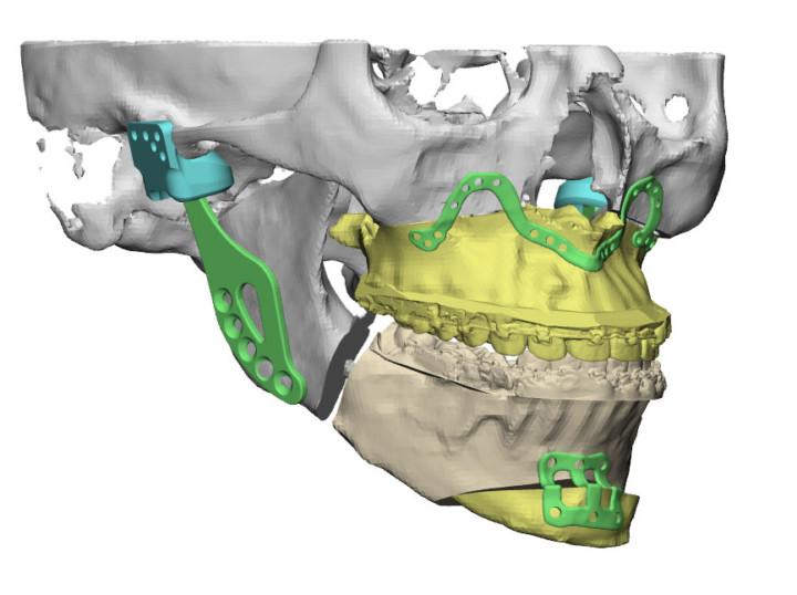 Dr Michael Burgess Maxillofacial Surgeon Brisbane